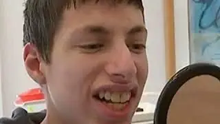 Как сейчас выглядит мальчик с самыми большими зубами
