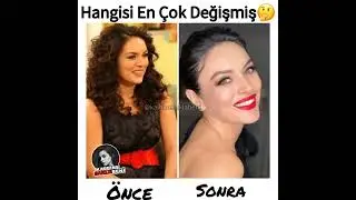 Hangisi En Çok Değişmiş🤗