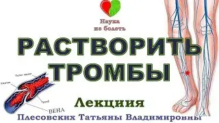 ТРОМБОНЕТ -||- АКТИВАЦИЯ КРОВОТОКА -||- УЛУЧШЕНИЕ КРОВОТОКА - ВАРИКОЗ