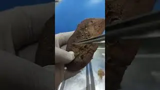 Real Human Hemi-Sectioned Kidney:  A Detailed View