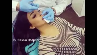 Rola Yamout Heart Shaped Lips by Dr. Toni Nassar