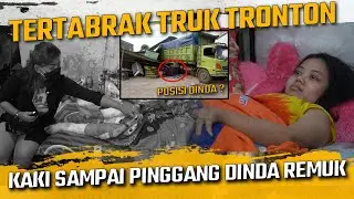 TERTABRAK TRUK TRONTON KAKI SAMPAI PINGGANG DINDA PATAH DAN REMUK ??!