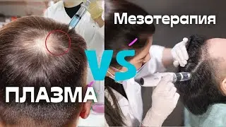 ПЛАЗМА ПРОТИВ МЕЗОТЕРАПИИ ДЛЯ ВОЛОС. ЧТО ВЫБРАТЬ? ЧТО ЛУЧШЕ | PRP для волос | Regenera Activa