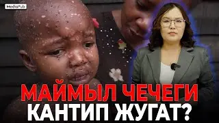 Маймыл чечек оорусу эмнеси менен кооптуу?