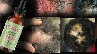 The Dangers of Rosemary Oil & Hair Oils
