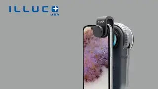 ILLUCO IDS 1100 Dermatoscope with phone compatibility
