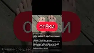 ПОМОЩЬ ПРИ ОТЁКАХ. БЫСТРО ПРОХОДЯТ. #отеки #отёки #отеклиноги #отекног #ноги
