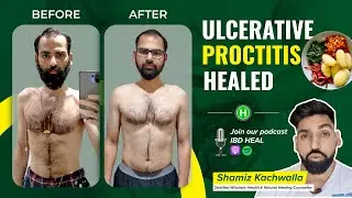 Anand gets rid of Ulcerative Proctitis | Med free