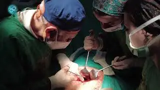 Organ Sarkması Ameliyatı Nasıl Yapılır? Prof. Dr. Yavuz Önol