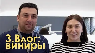 3.Виниры-интервью с главным врачом, все шаги установки винир , поездка в Краснодар