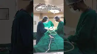 LIVE SURGERY ❤️ #OMG #viral Maxillofacial Team