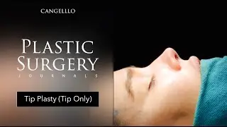 Tip Plasty Surgery (Tip Only) | Plastic Surgery Journals | Cangello Plastic Surgery