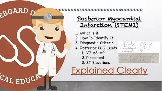 Posterior Myocardial Infarction On 12 Lead ECG - Diagnostic Criteria AND Posterior Leads V7, V8, V9