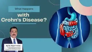 What Happens with Crohn's Disease? Explained by Dr. Rajat Trehan