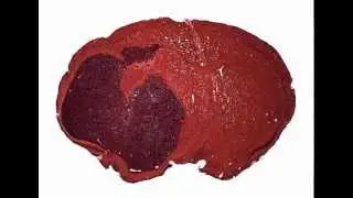 Mouse brain with intracranial tumors