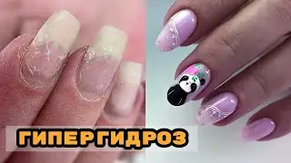 HYPERHYDROSIS 🥺 How to work with it? 💅 Manicure with Si spring gels