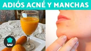 Juice to eliminate acne and blemishes on the skin 🥕✅ Clean and radiant skin!