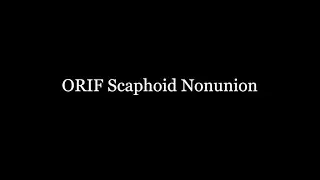 Scaphoid Nounion ORIF Surgery