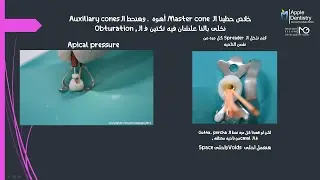 obturation technique : lateral compaction