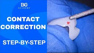 Contact correction: step by step