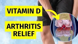 Vitamin D Supplement for Joint Pain - What Science ACTUALLY Says
