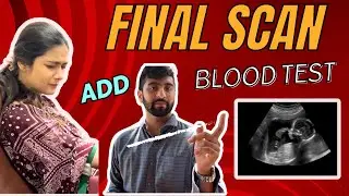 Doctor is Angry with US !! 👿 Final Pregnancy Scan and Test Reports 😱