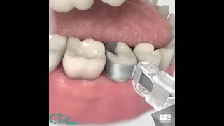 Matriz Omni Matrix - ULTRADENT