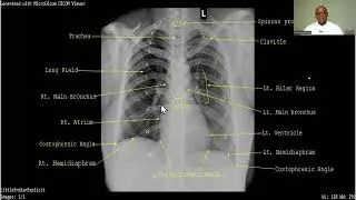 RADIOGRAPHIC ANATOMY OF THE CHEST MADE SIMPLE FOR 200 LEVEL MEDICAL & ALLIED HEALTH ANATOMY STUDENTS