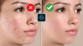 Skin pimples in Photoshop | Way Remove clean your face  | In 2 Minute