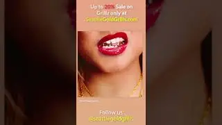 Best Deal on Gold Grillz by Seattle Gold Grills