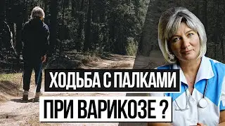 Скандинавская ходьба при варикозе. Можно ли заниматься спортом при варикозе?