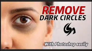 Remove Dark Eyes Circles Faster On Photoshop