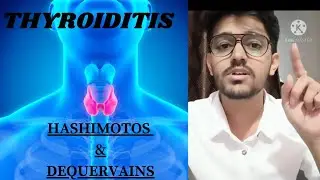 THYROIDITIS - DeQuervains & Hashimotos - Symptoms | Pathophysiology | Differential diagnosis