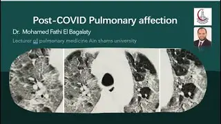 POST COVID PULM AFFECTION Dr  M Fathi