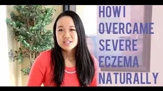 How I Overcame Severe Eczema Naturally