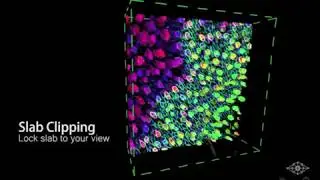 Data Clipping