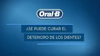 ¿Como prevenir las caries dentales?
