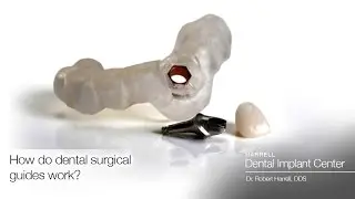 How does a surgical guide work?