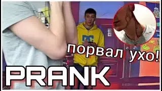ПОРВАЛ УХО ДО КРОВИ! СИЛЬНОЕ КРОВОТЕЧЕНИЕ В УХЕ, СТРАШНЫЙ ПРАНК НАД ДРУГОМ!