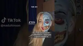 How does a woman with a disappearing face live?