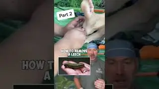 Removing a Leech the Right Way 🩸 