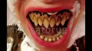 richi-crooks(remix)