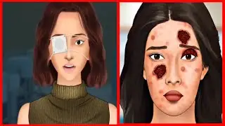 ASMR Eye discharge removal animation -Eyelid big acne extrusion and lashes lice deep cleaning