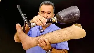 Realistic Cosmetic silicone prosthetic By #bestcare_medical_dubai #viral #viralvideo