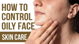 How To Get Rid Of Oily Skin Naturally - Home Remedies For Oily Skin.