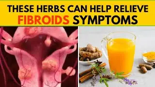10 Powerful Herbs to Relieve Fibroid Symptoms