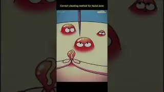 Method for facial acne