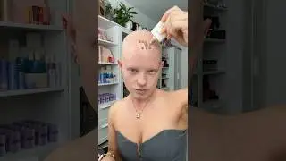 I don’t wear wigs for having Alopecia…