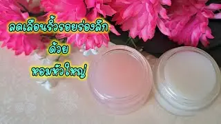 ลดเลือนริ้วรอยด้วยหอมหัวใหญ่ Reduce wrinkles with onions