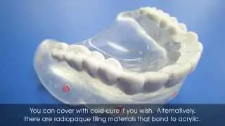 Create a scan appliance with Lang’s Duplicator Flask and Jet™ XR for radiopaque acrylic